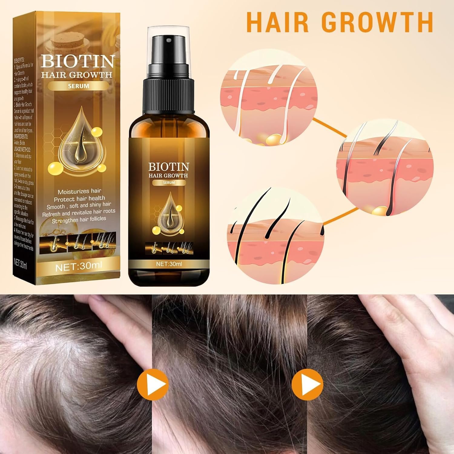 Ninnyi 2PCS 30ml Hair Growth Spray with Biotin, for Thicker Longer Stronger Hair - Image 2
